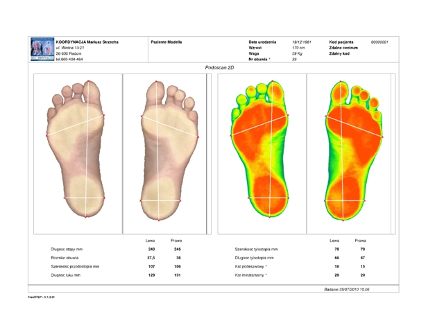 Komputerowe Badanie Stóp 7017